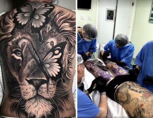Conselho Federal de Medicina proíbe o uso de anestesia geral e sedação para realização de tatuagem